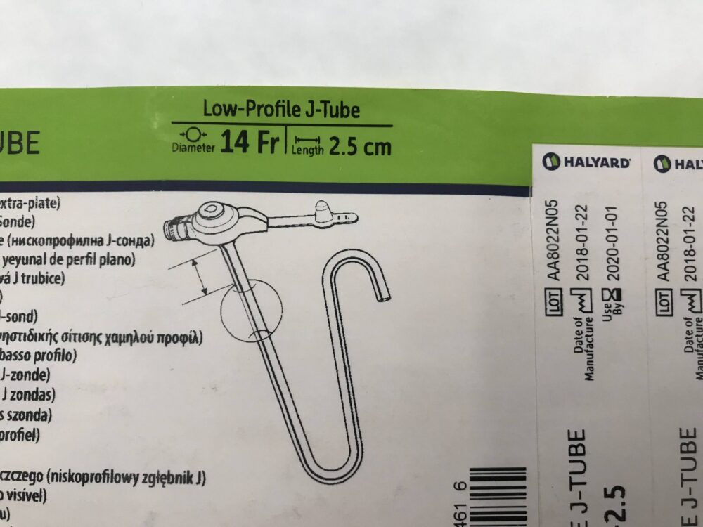Halyard 0230142.5 MicKey* Jejunal Feeding Tube LowProfile JTube 14Fr (X) GB TECH USA